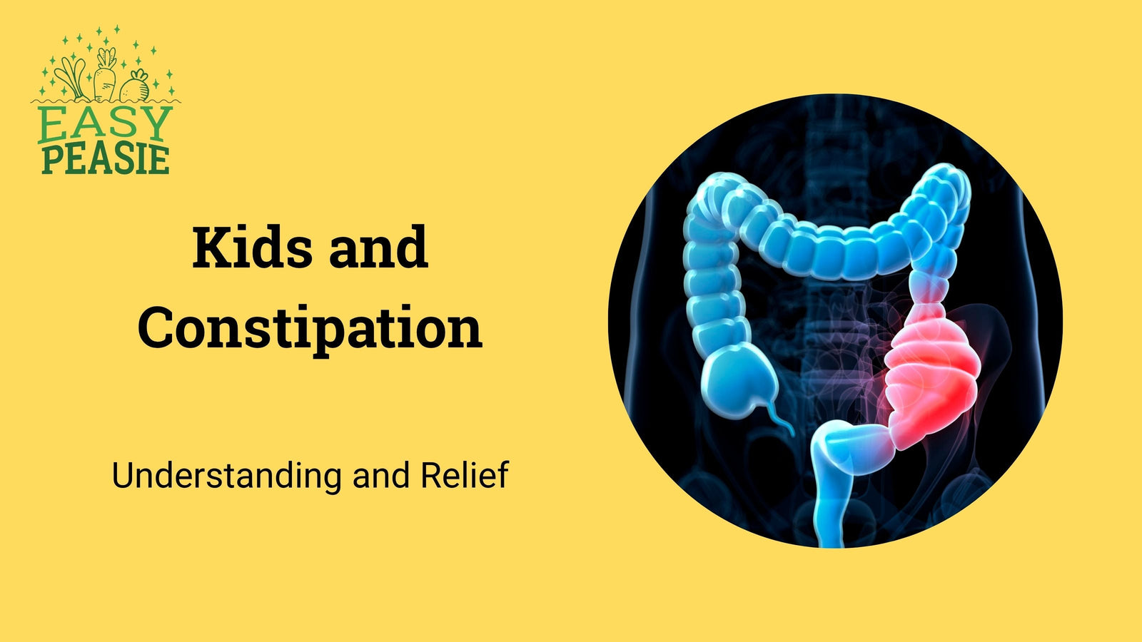 Kids and Constipation: Understanding and Relief